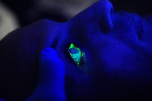 Ophtalmologie