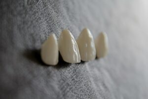 Remplacer une dent manquante