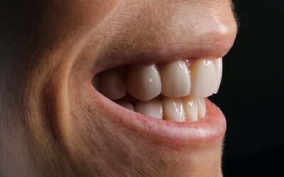 Remplacer une dent manquante